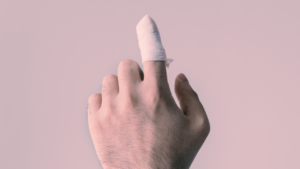 indemnización amputación dedo mano
